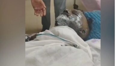 सवाईमाधोपुर; युवक की झुलसने से मौत, आरोप: जिंदा जलाया…पुलिस मान रही आत्मदाह