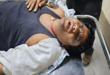 कार सवार बदमाशों ने पहले बाइक के टक्कर मारकर गिराया, फिर लाठियों व हॉकी स्टिक से की संगीन मारपीट