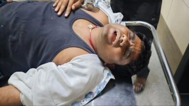 कार सवार बदमाशों ने पहले बाइक के टक्कर मारकर गिराया, फिर लाठियों व हॉकी स्टिक से की संगीन मारपीट