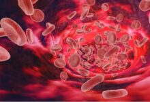 वर्ल्ड हीमोफीलिया : छोटी सी चोट भी जानलेवा, क्लोटिंग फेक्टर की कमी से जूझ रहे शहर में 400 से ज्यादा मरीज