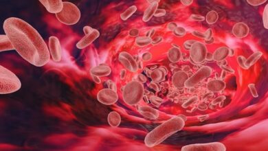 वर्ल्ड हीमोफीलिया : छोटी सी चोट भी जानलेवा, क्लोटिंग फेक्टर की कमी से जूझ रहे शहर में 400 से ज्यादा मरीज